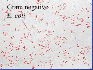 Gram negative E. coli 