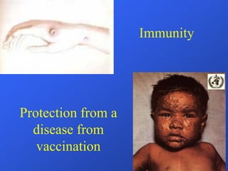 Protection from a
disease from
vaccination
Immunity
 