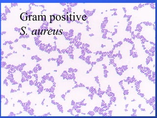 Gram positive
S. aureus
 