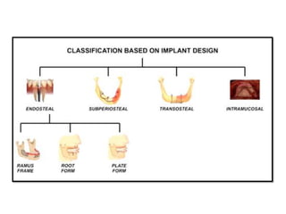 History & Classification of Implants.pdf