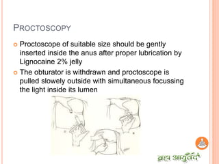 History taking and examination in ano rectal diseases | PPTX