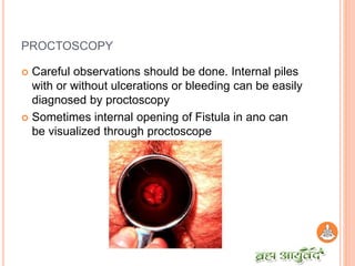 History taking and examination in ano rectal diseases | PPTX