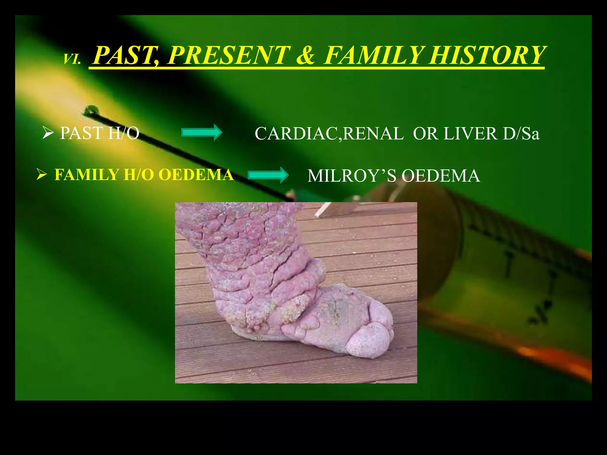 VI.   PAST, PRESENT & FAMILY HISTORY

 PAST H/O            CARDIAC,RENAL OR LIVER D/Sa

 FAMILY H/O OEDEMA       MILROY’S OEDEMA
 