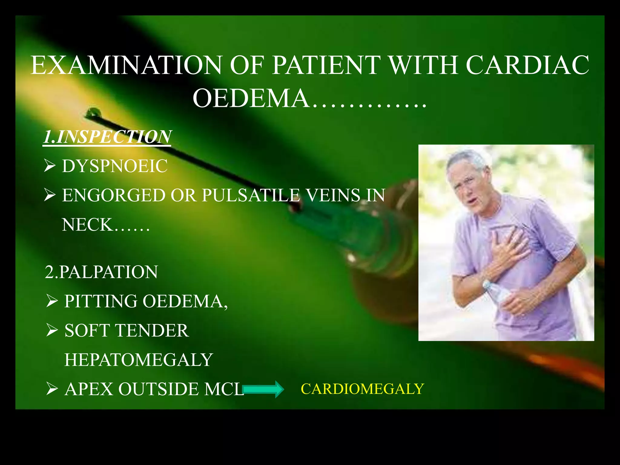 EXAMINATION OF PATIENT WITH CARDIAC
         OEDEMA………….
1.INSPECTION
 DYSPNOEIC
 ENGORGED OR PULSATILE VEINS IN
 NECK……

2.PALPATION
 PITTING OEDEMA,
 SOFT TENDER
  HEPATOMEGALY
 APEX OUTSIDE MCL      CARDIOMEGALY
 
