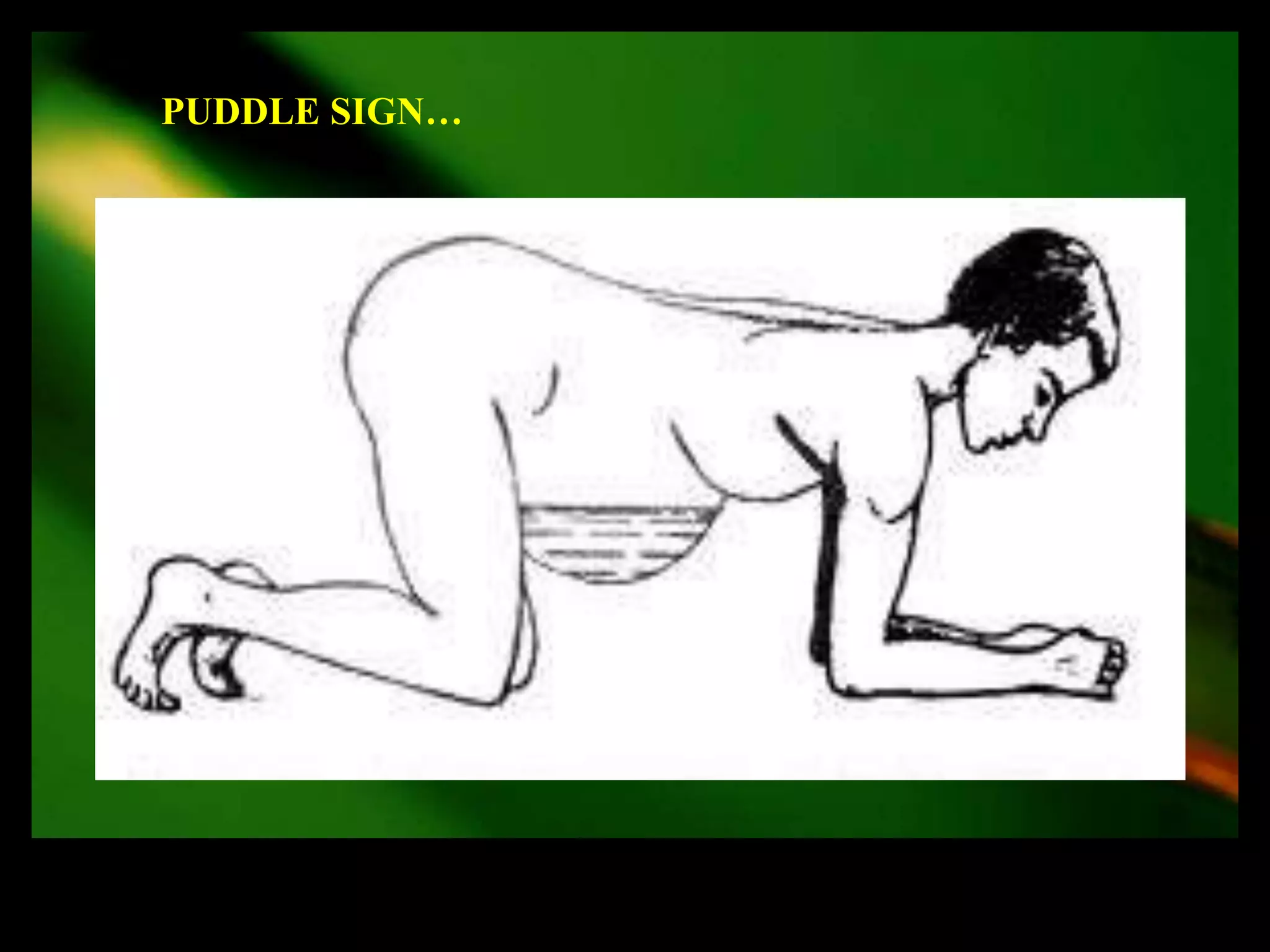 PUDDLE SIGN…
 