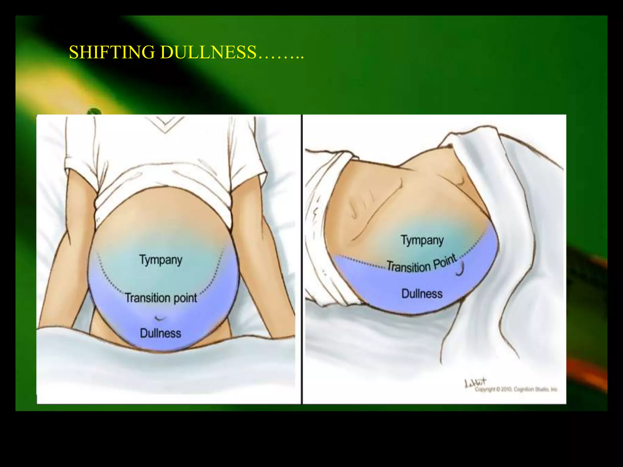 SHIFTING DULLNESS……..
 