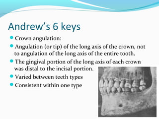Andrew’s 6 keys
Crown angulation:
Angulation (or tip) of the long axis of the crown, not
to angulation of the long axis of the entire tooth.
The gingival portion of the long axis of each crown
was distal to the incisal portion.
Varied between teeth types
Consistent within one type
 