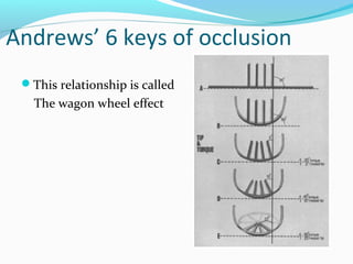 Andrews’ 6 keys of occlusion
This relationship is called
The wagon wheel effect
 