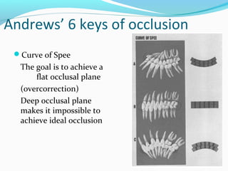 Andrews’ 6 keys of occlusion
Curve of Spee
The goal is to achieve a
flat occlusal plane
(overcorrection)
Deep occlusal plane
makes it impossible to
achieve ideal occlusion
 