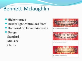 Bennett-Mclaughlin
Higher torque
Deliver light continuous force
Decreased tip for anterior teeth
Design :
Standard
Mid-size
Clarity
 