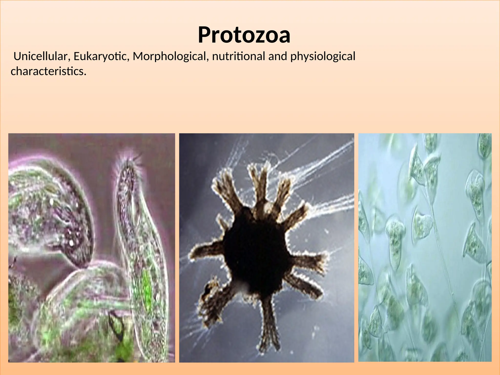 Protozoa
Unicellular, Eukaryotic, Morphological, nutritional and physiological
characteristics.
 