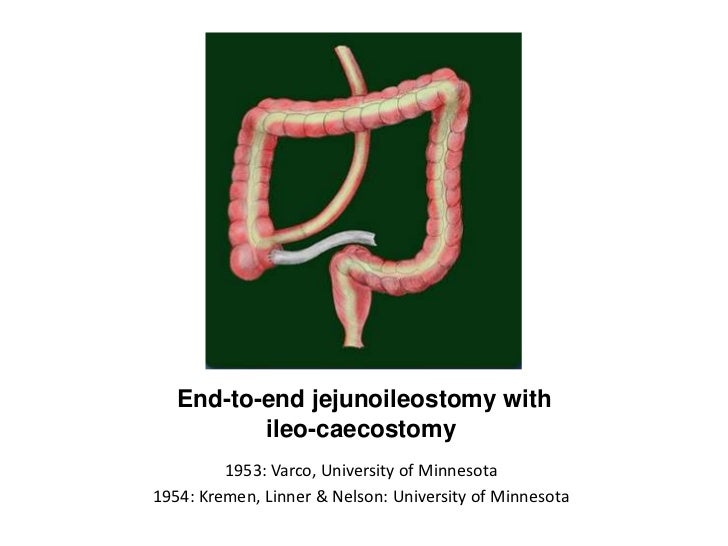 History of bariatric surgery