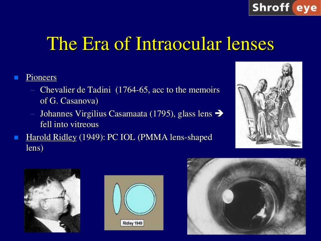 History of Cataract Surgery