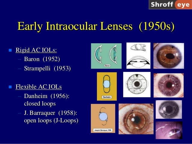 History of Cataract Surgery