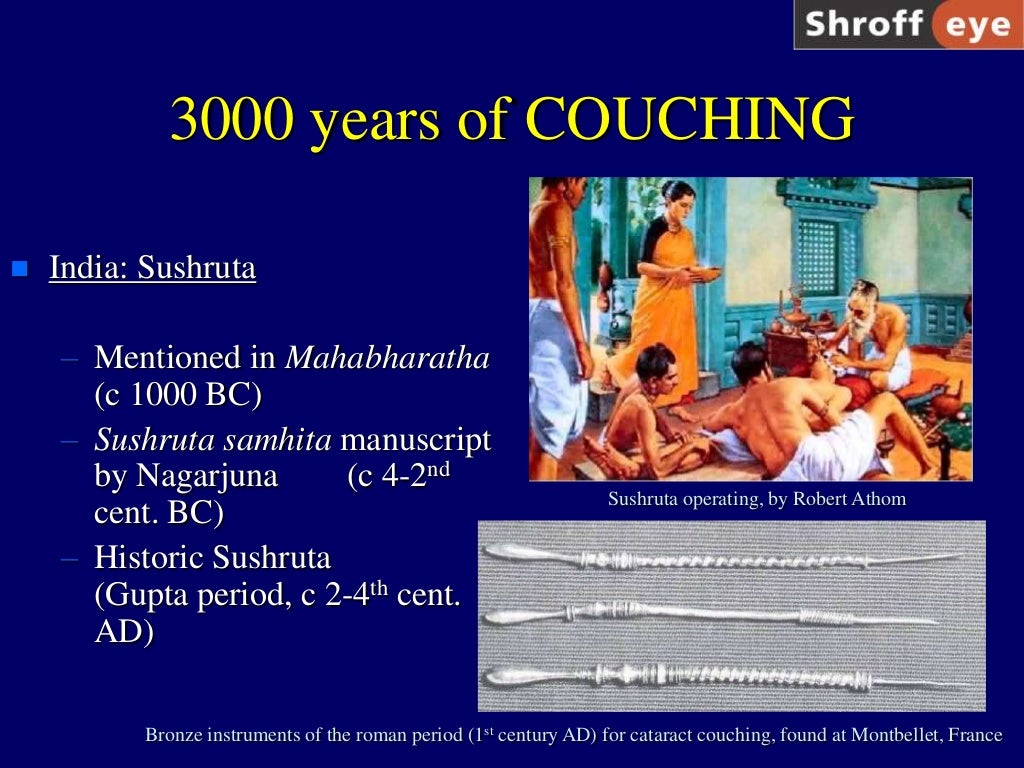 History of Cataract Surgery