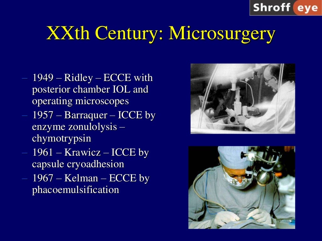 History of Cataract Surgery