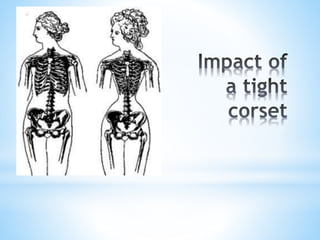 History of corsets