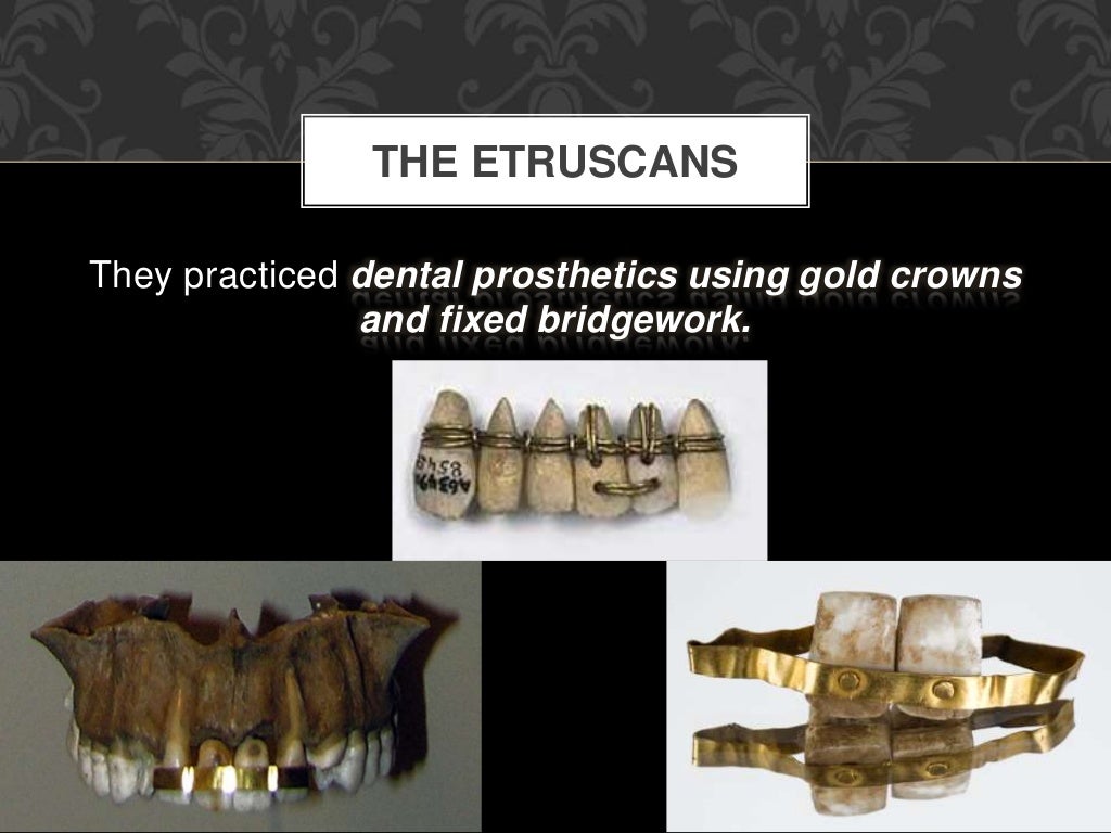 History Of Dentistry