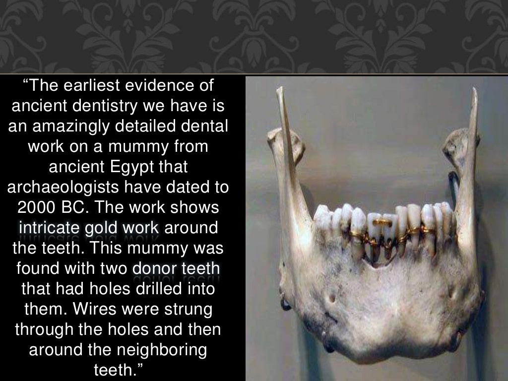 History Of Dentistry