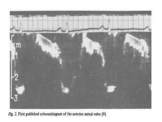 History of echocardiography | PPTX