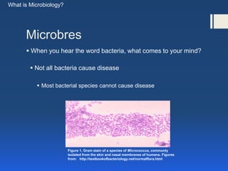 Microbres
 When you hear the word bacteria, what comes to your mind?
What is Microbiology?
 Not all bacteria cause disea...