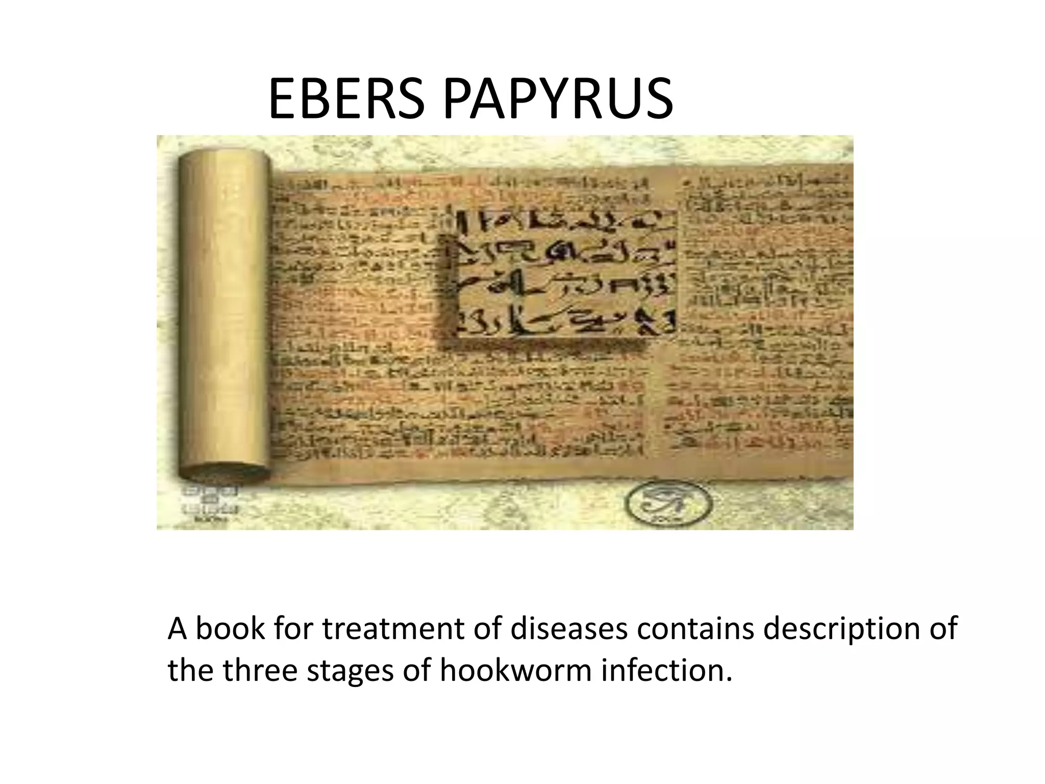 EBERS PAPYRUS
A book for treatment of diseases contains description of
the three stages of hookworm infection.
 
