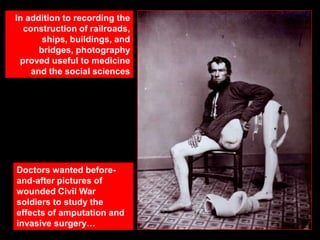 In addition to recording the
construction of railroads,
ships, buildings, and
bridges, photography
proved useful to medicine
and the social sciences

Doctors wanted beforeand-after pictures of
wounded Civil War
soldiers to study the
effects of amputation and
invasive surgery…

 