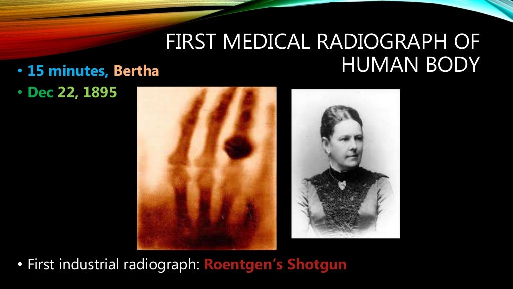 History of radiology