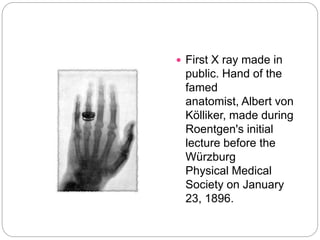 First Radiographers Hand HISTORY OF RADIOLOGY ppt.pptx