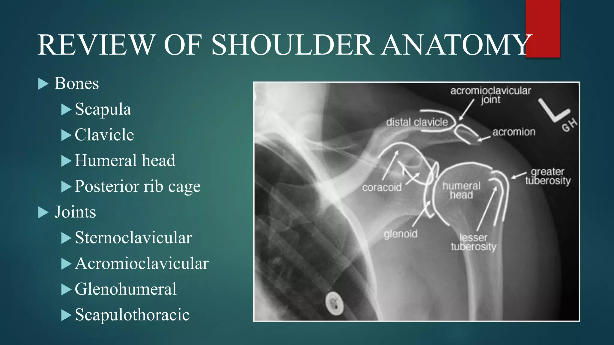 REVIEW OF SHOULDER ANATOMY
 Bones
Scapula
Clavicle
Humeral head
Posterior rib cage
 Joints
Sternoclavicular
Acromioclavicular
Glenohumeral
Scapulothoracic
 
