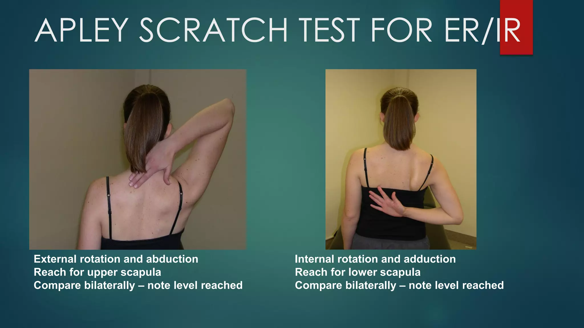 APLEY SCRATCH TEST FOR ER/IR
Internal rotation and adduction
Reach for lower scapula
Compare bilaterally – note level reached
External rotation and abduction
Reach for upper scapula
Compare bilaterally – note level reached
 