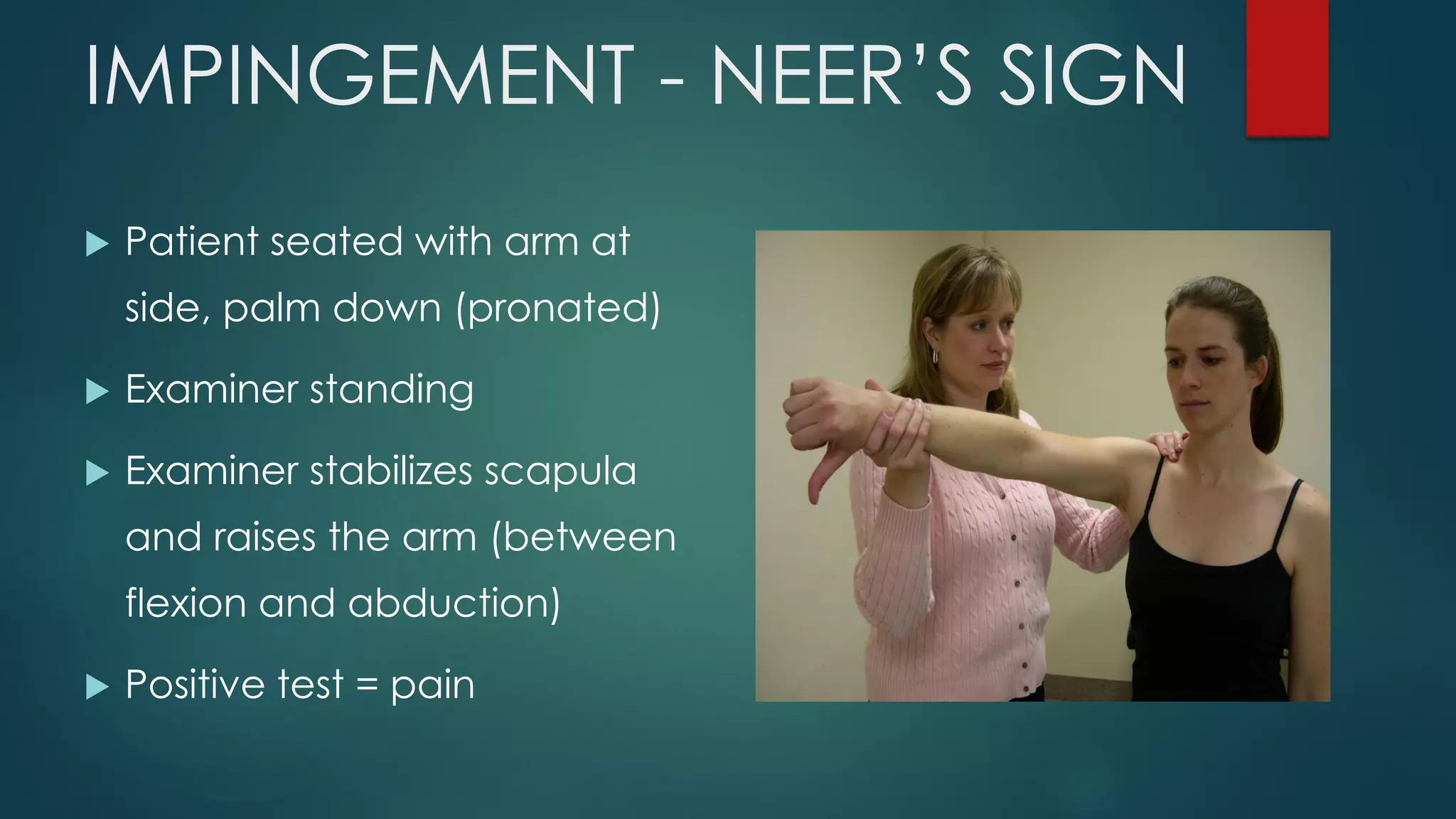 IMPINGEMENT - NEER’S SIGN
 Patient seated with arm at
side, palm down (pronated)
 Examiner standing
 Examiner stabilizes scapula
and raises the arm (between
flexion and abduction)
 Positive test = pain
 