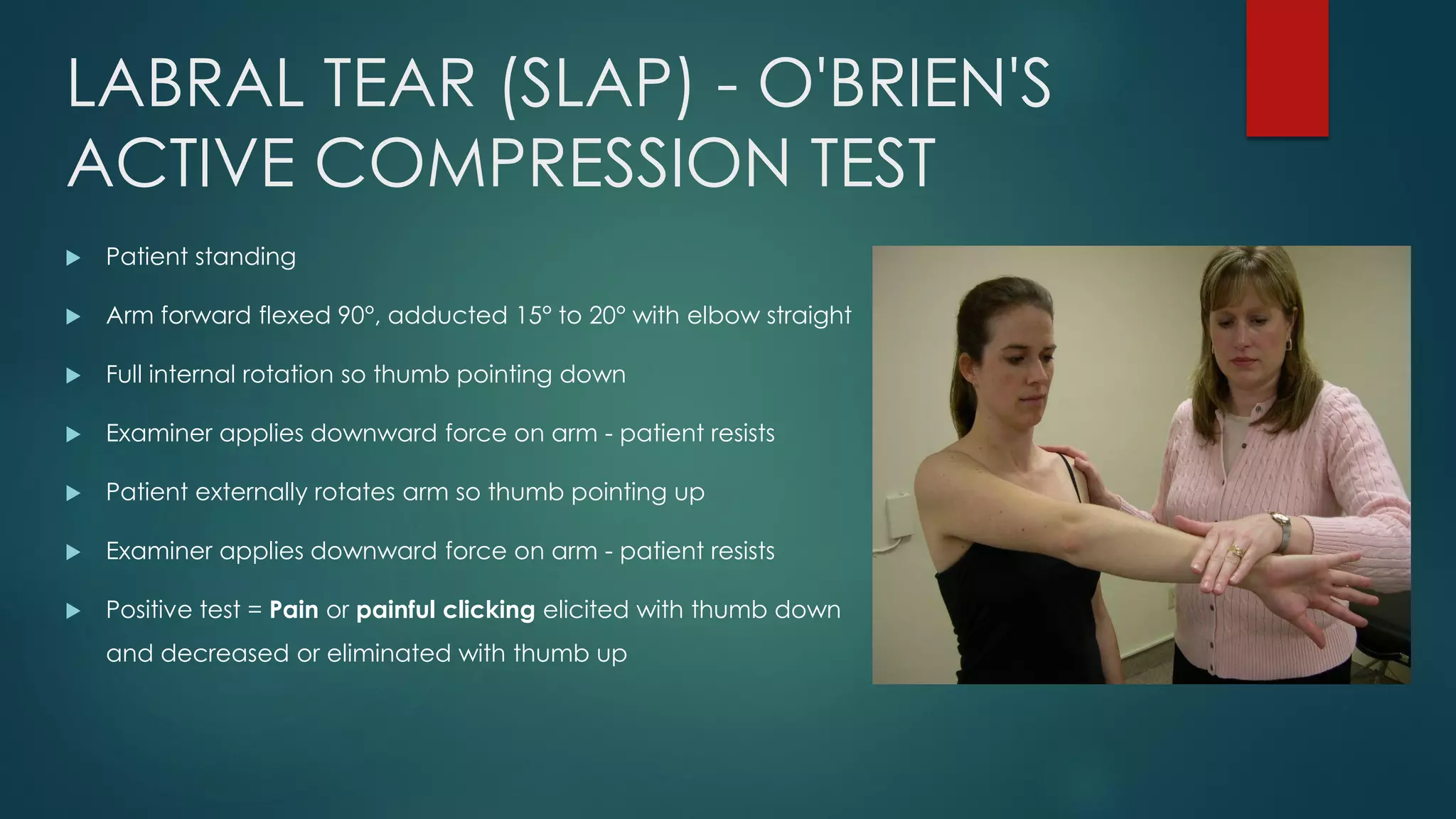 LABRAL TEAR (SLAP) - O'BRIEN'S
ACTIVE COMPRESSION TEST
 Patient standing
 Arm forward flexed 90°, adducted 15° to 20° with elbow straight
 Full internal rotation so thumb pointing down
 Examiner applies downward force on arm - patient resists
 Patient externally rotates arm so thumb pointing up
 Examiner applies downward force on arm - patient resists
 Positive test = Pain or painful clicking elicited with thumb down
and decreased or eliminated with thumb up
 
