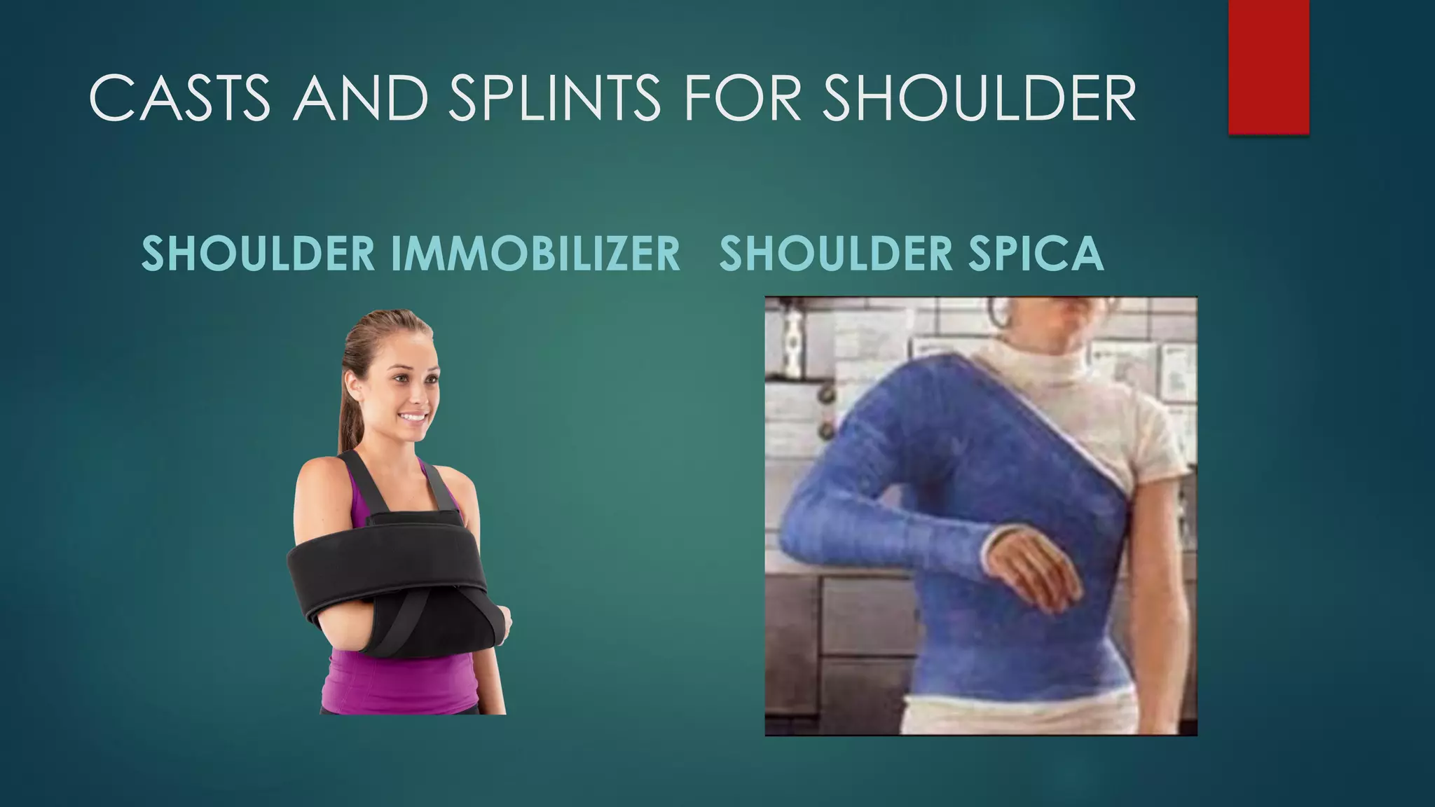CASTS AND SPLINTS FOR SHOULDER
SHOULDER IMMOBILIZER SHOULDER SPICA
 