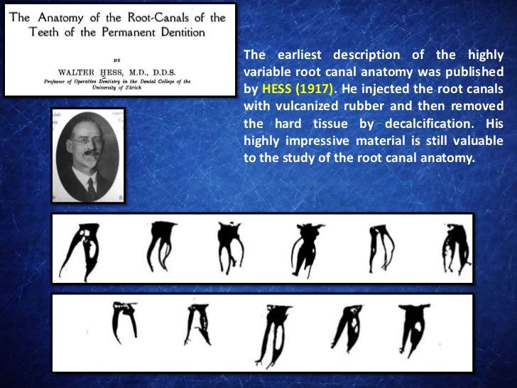 A Brief History of the First Studies on the Root Canal Anatomy