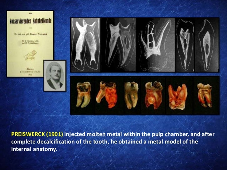 A Brief History of the First Studies on the Root Canal Anatomy