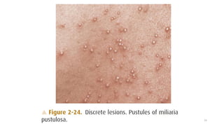 Approach to the diagnosis of dermatological disease | PPTX