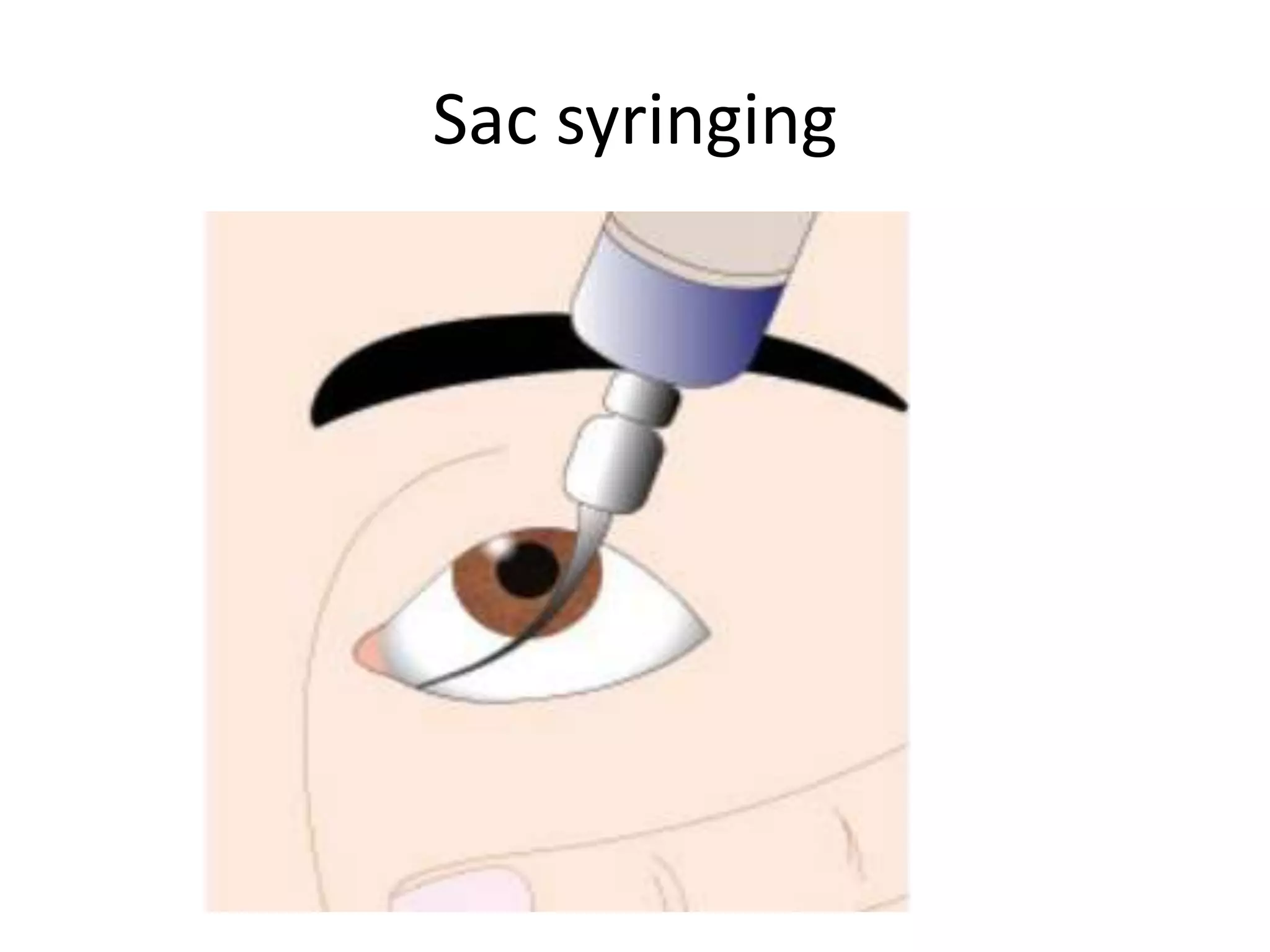 History taking and case examination OF EYE | PPTX