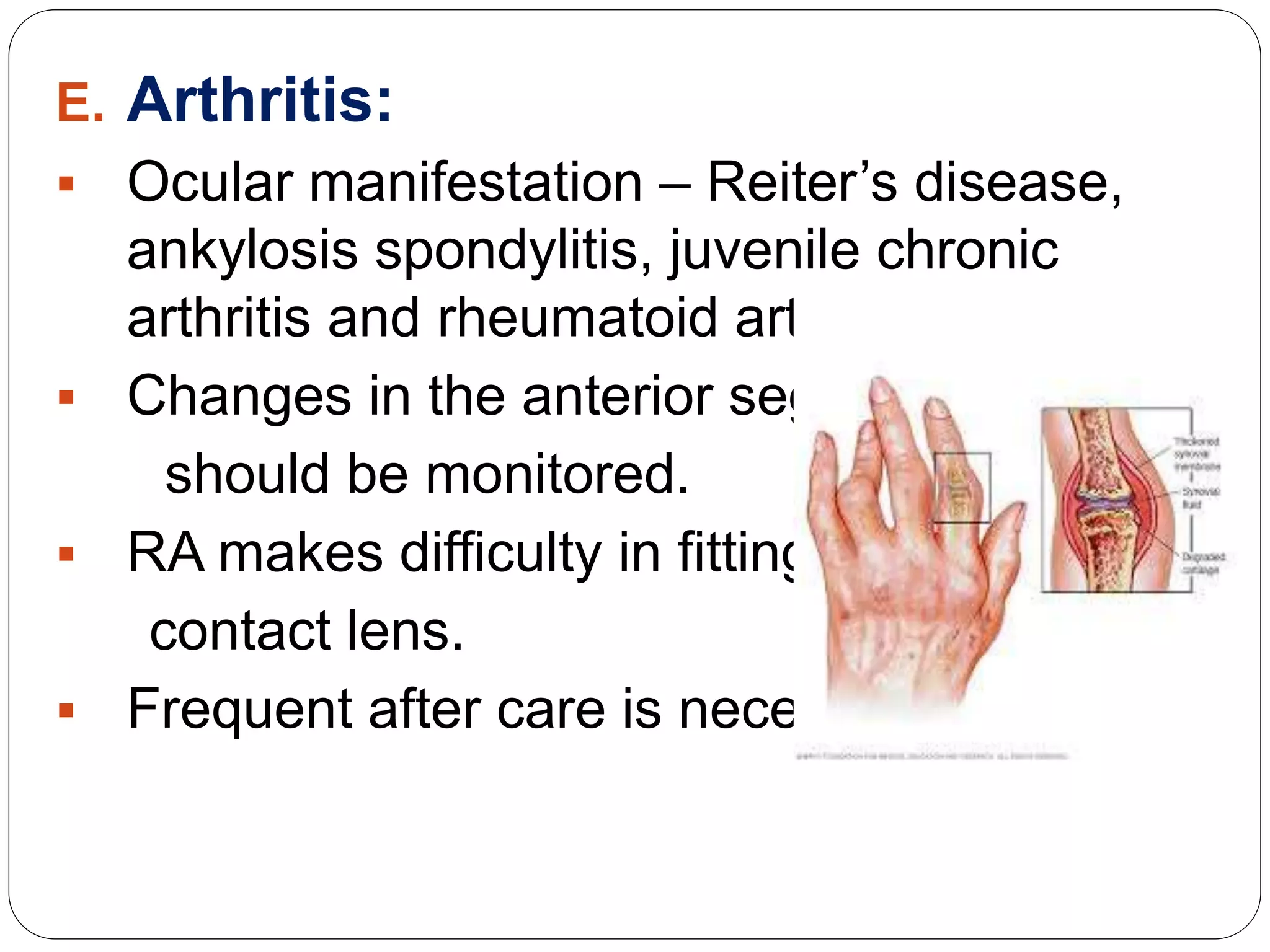 E. Arthritis:
 Ocular manifestation – Reiter’s disease,
ankylosis spondylitis, juvenile chronic
arthritis and rheumatoid arthritis(RA).
 Changes in the anterior segment
should be monitored.
 RA makes difficulty in fitting
contact lens.
 Frequent after care is necessary.
 