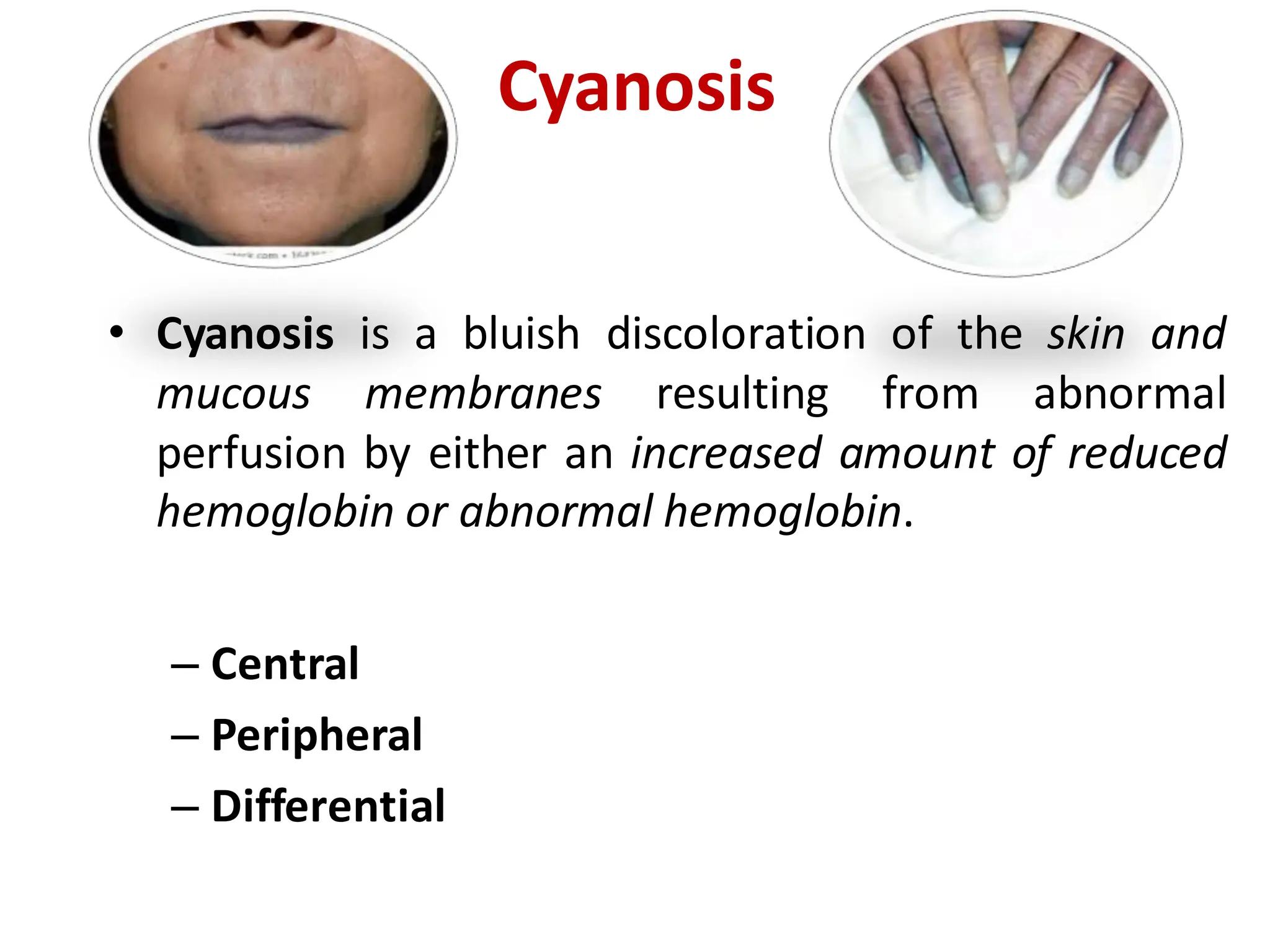 Cyantic History Taking and Physical Examination of Cardiovascular System-The ...