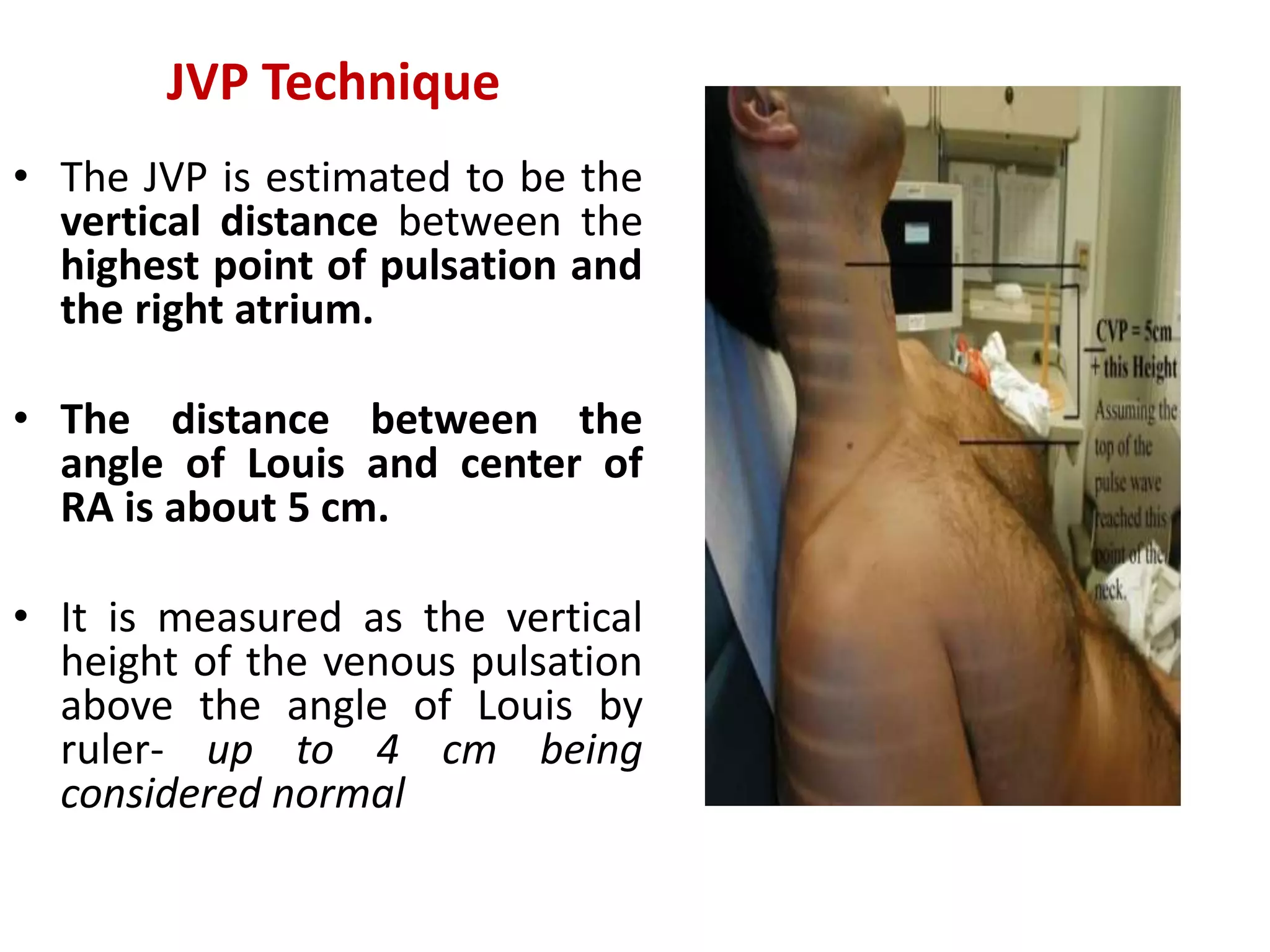 History Taking and Physical Examination of Cardiovascular System-The ...
