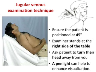 • Ensure the patient is
positioned at 45°
• Examiner stands at the
right side of the table
• Ask patient to turn their
head away from you
• A penlight can help to
enhance visualization.
Jugular venous
examination technique
 