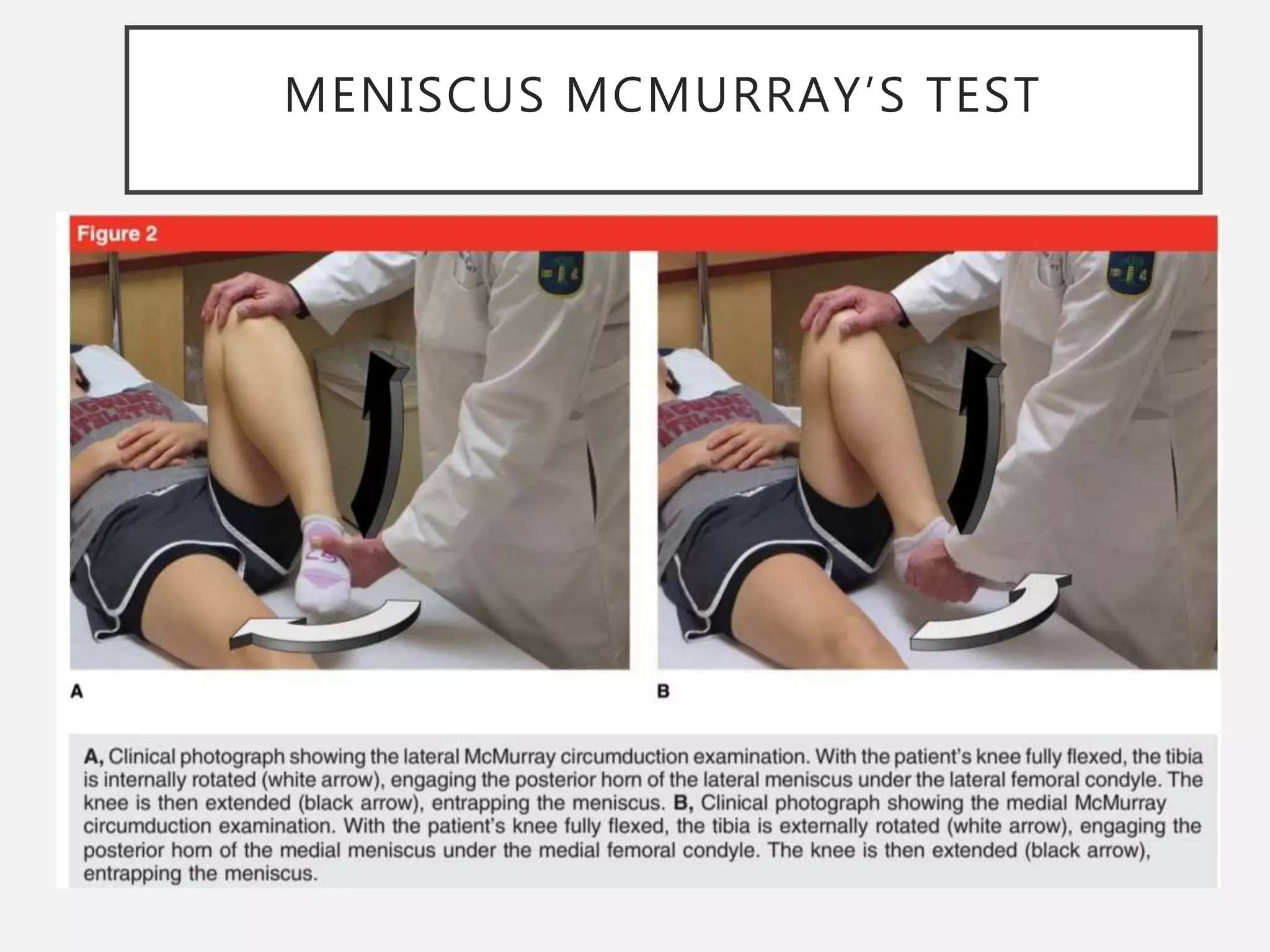 History taking and physical examination of the knee | PPTX
