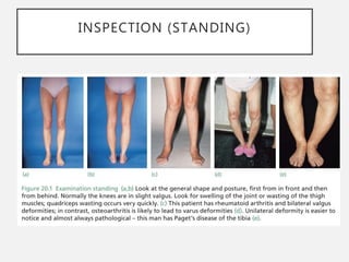 History taking and physical examination of the knee | PPTX