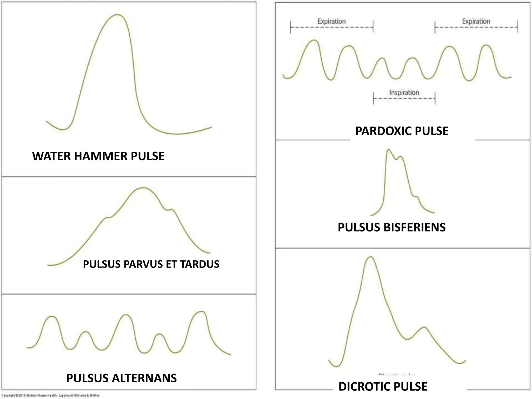 History Taking Examination Of Cardiovascular System PPTX