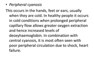 • Peripheral cyanosis
This occurs in the hands, feet or ears, usually
when they are cold. In healthy people it occurs
in cold conditions when prolonged peripheral
capillary flow allows greater oxygen extraction
and hence increased levels of
deoxyhaemoglobin. In combination with
central cyanosis, it is most often seen with
poor peripheral circulation due to shock, heart
failure.
 