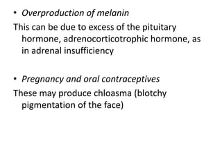 • Overproduction of melanin
This can be due to excess of the pituitary
hormone, adrenocorticotrophic hormone, as
in adrenal insufficiency
• Pregnancy and oral contraceptives
These may produce chloasma (blotchy
pigmentation of the face)
 