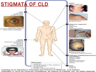 STIGMATA OF CLD
 