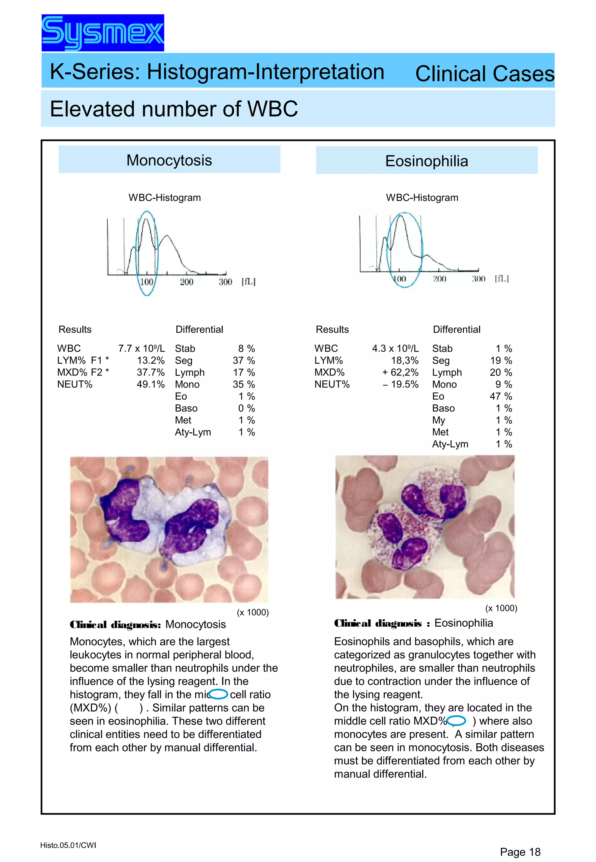 K-Series: Histogram-Interpretation
Histo.05.01/CWI
Page 18
Clinical diagnosis : Eosinophilia
Eosinophils and basophils, which are
categorized as granulocytes together with
neutrophiles, are smaller than neutrophils
due to contraction under the influence of
the lysing reagent.
On the histogram, they are located in the
middle cell ratio MXD% ( ) where also
monocytes are present. A similar pattern
can be seen in monocytosis. Both diseases
must be differentiated from each other by
manual differential.
Monocytosis
Stab
Seg
Lymph
Mono
Eo
Baso
Met
Aty-Lym
8 %
37 %
17 %
35 %
1 %
0 %
1 %
1 %
Differential
WBC
LYM%
MXD%
NEUT%
Results
7.7 x 109
/L
F1 * 13.2%
F2 * 37.7%
49.1%
Eosinophilia
Stab
Seg
Lymph
Mono
Eo
Baso
My
Met
Aty-Lym
1 %
19 %
20 %
9 %
47 %
1 %
1 %
1 %
1 %
Differential
WBC
LYM%
MXD%
NEUT%
Results
4.3 x 109
/L
18,3%
+ 62,2%
– 19.5%
(x 1000) (x 1000)
WBC-Histogram WBC-Histogram
Clinical Cases
Elevated number of WBC
Clinical diagnosis: Monocytosis
Monocytes, which are the largest
leukocytes in normal peripheral blood,
become smaller than neutrophils under the
influence of the lysing reagent. In the
histogram, they fall in the middle cell ratio
(MXD%) ( ) . Similar patterns can be
seen in eosinophilia. These two different
clinical entities need to be differentiated
from each other by manual differential.
 