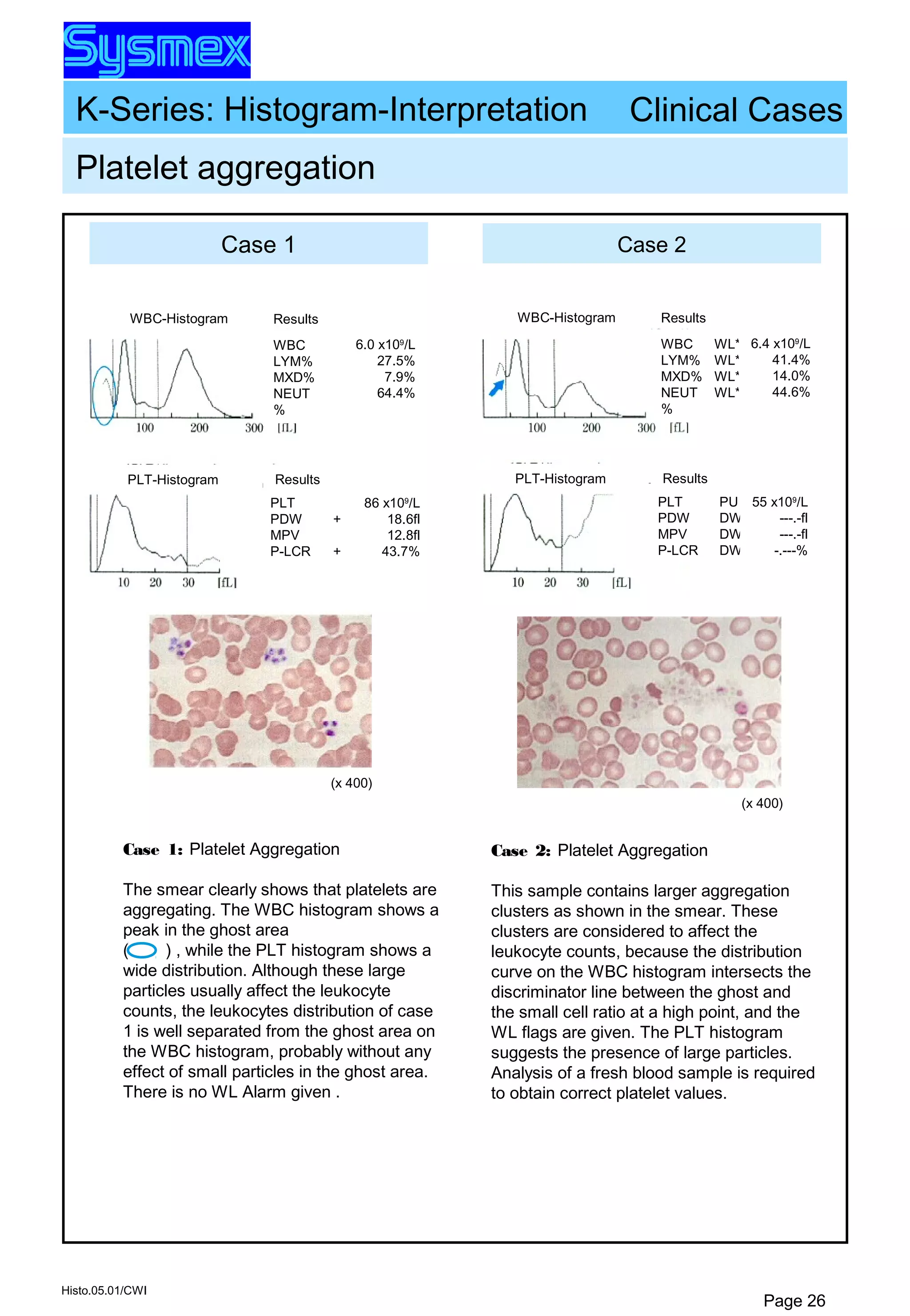 K-Series: Histogram-Interpretation
Histo.05.01/CWI
Page 26
Case 1 Case 2
Platelet aggregation
WBC-Histogram Results
WBC
LYM%
MXD%
NEUT
%
6.0 x109
/L
27.5%
7.9%
64.4%
Results
PLT
PDW
MPV
P-LCR
+
+
86 x109
/L
18.6fl
12.8fl
43.7%
PLT-Histogram
(x 400)
WBC-Histogram Results
WBC
LYM%
MXD%
NEUT
%
WL*
WL*
WL*
WL*
6.4 x109
/L
41.4%
14.0%
44.6%
Results
PLT
PDW
MPV
P-LCR
PU
DW
DW
DW
55 x109
/L
---.-fl
---.-fl
-.---%
PLT-Histogram
(x 400)
Clinical Cases
Case 1: Platelet Aggregation
The smear clearly shows that platelets are
aggregating. The WBC histogram shows a
peak in the ghost area
( ) , while the PLT histogram shows a
wide distribution. Although these large
particles usually affect the leukocyte
counts, the leukocytes distribution of case
1 is well separated from the ghost area on
the WBC histogram, probably without any
effect of small particles in the ghost area.
There is no WL Alarm given .
Case 2: Platelet Aggregation
This sample contains larger aggregation
clusters as shown in the smear. These
clusters are considered to affect the
leukocyte counts, because the distribution
curve on the WBC histogram intersects the
discriminator line between the ghost and
the small cell ratio at a high point, and the
WL flags are given. The PLT histogram
suggests the presence of large particles.
Analysis of a fresh blood sample is required
to obtain correct platelet values.
 